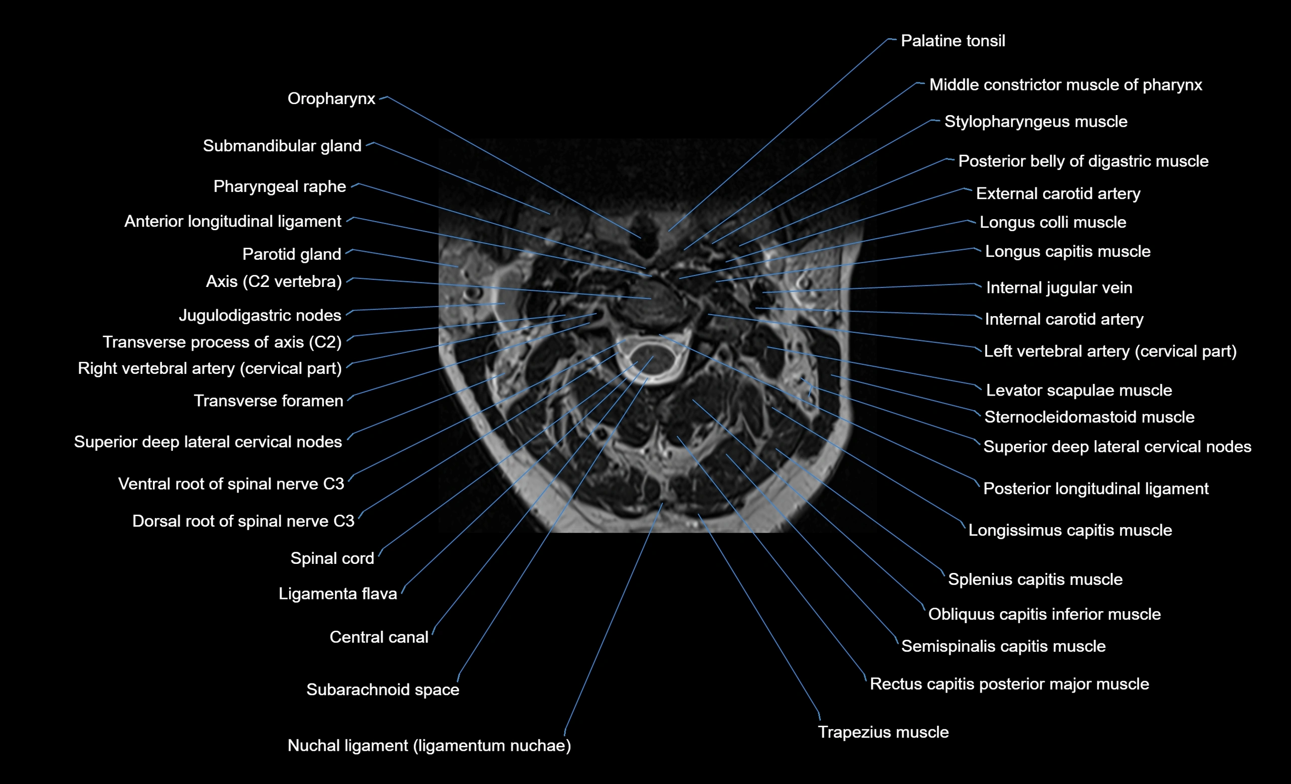 cervical spine cross sectional MRI anatomy  3T MRI axial  image-img-00001-00012.webp